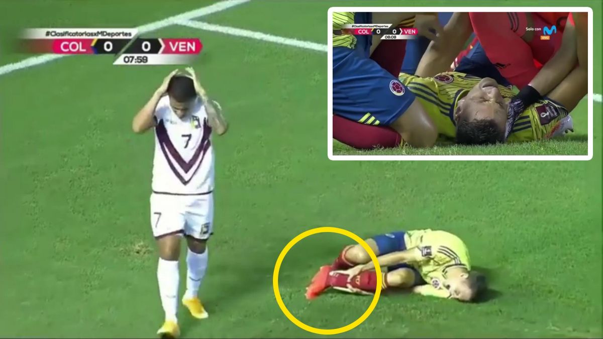 مصدومیت وحشتناک و دلخراش بازیکن کلمبیا در بازی مقابل ونزوئلا!