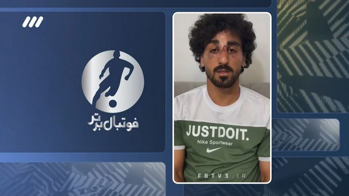 فوتبال برتر/ صحبتهای عیسی مرادی پس از مصدومیت وحشتناکی که برای او رخ داد
