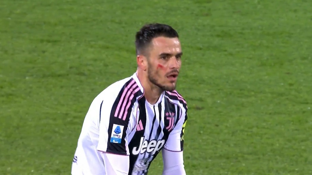 گل اول یوونتوس به فیورنتینا (سوپرگل فیلیپ کاستیچ)