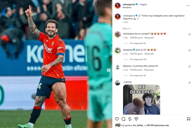 سوژه شدن عضلات پای مصنوعی ستاره اوساسونا (عکس)