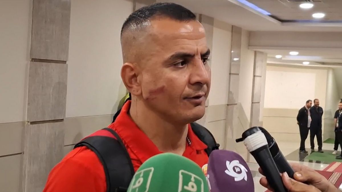 صحبتهای حامد لک بعد از بازی با ذوب آهن و زخم وحشتناک روی صورتش