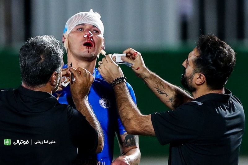 سه مصدوم استقلالی، تلفات آبیها بعد از شکست در دربی!