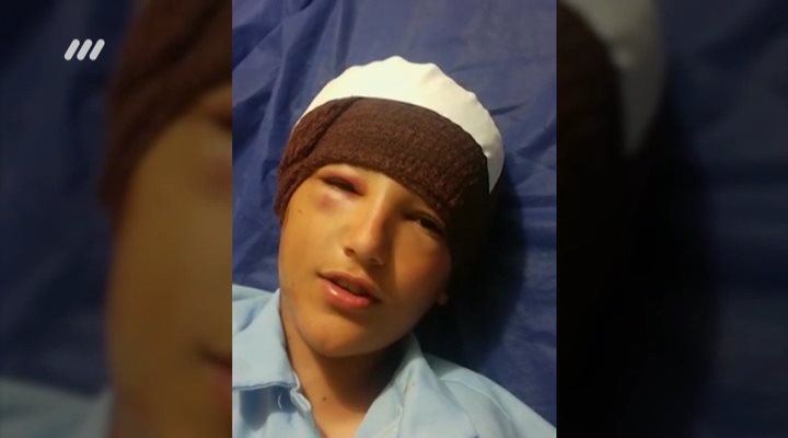 شکستن جمجمه هوادار نوجوان استقلال در اهواز (نود 13 اسفند)